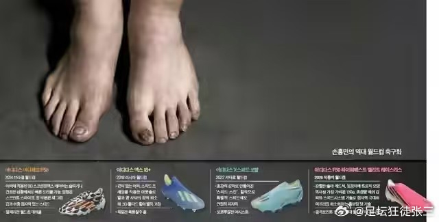 孙兴慜脚部严重扭曲变形