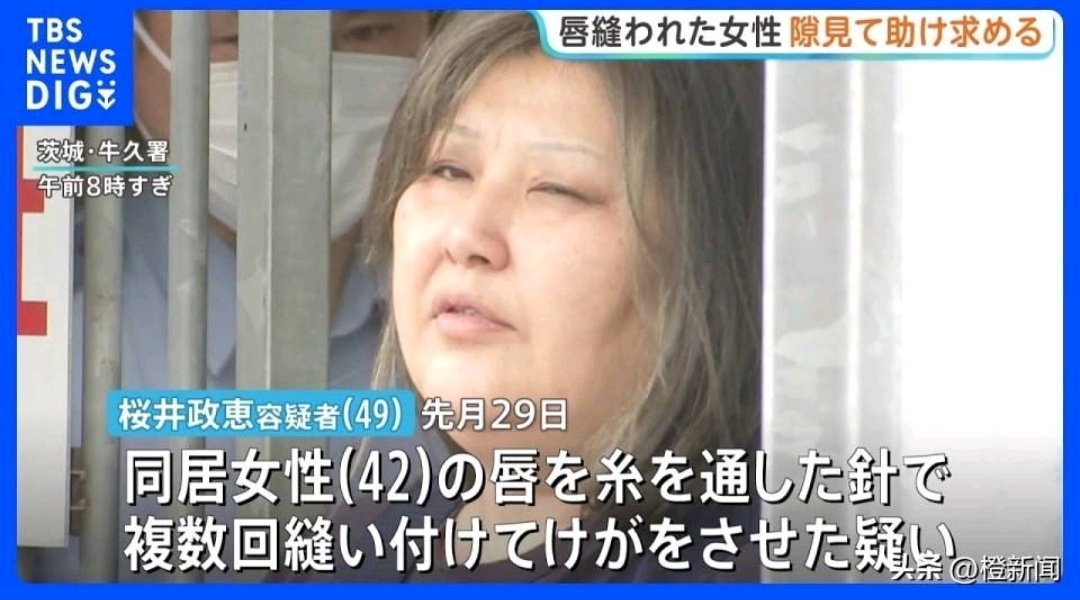 别的女生同居拌嘴顶多冷战，这位直接升级手工缝合工序，主打一个物理静音处理小日子就