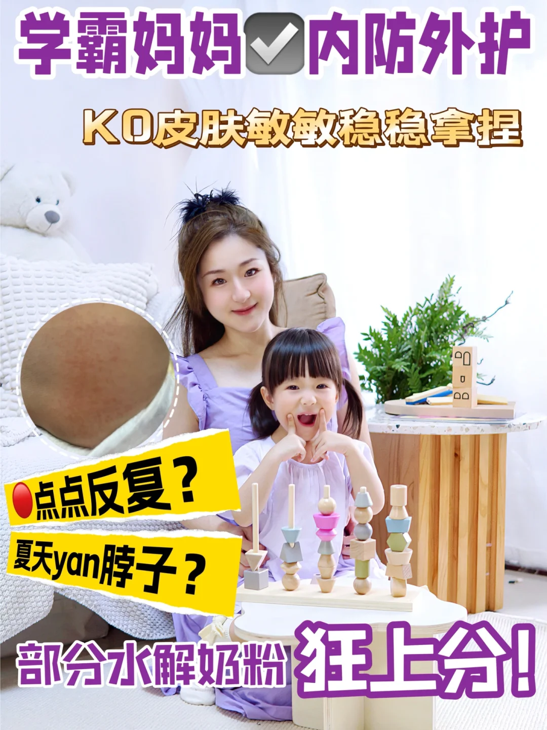海归学霸妈妈硬控出招！内防外护KO皮肤敏敏