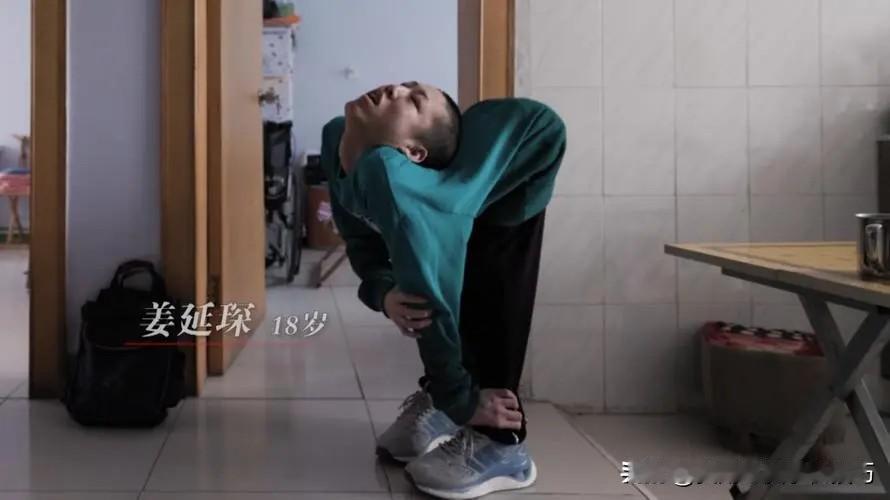 图中的是 00 后“折叠男孩”姜延琛，他的身体折成z字，只能跪着上学趴着高考，然