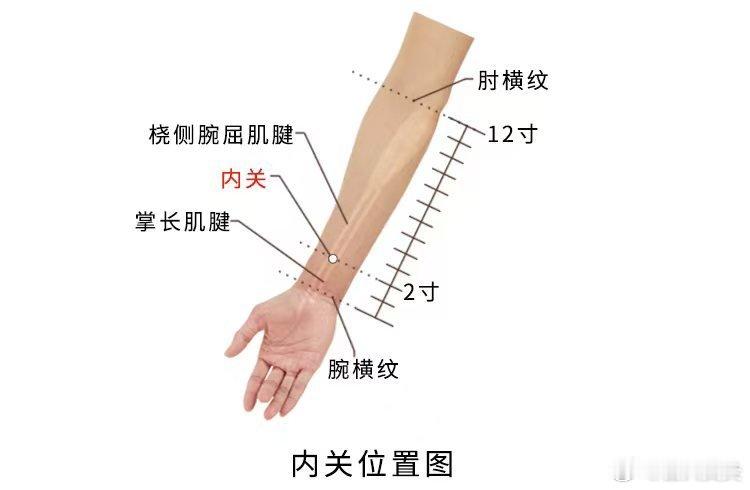  今日分享～内关穴精准取穴：在前臂前区，腕掌侧远端横纹上2寸，掌长肌腱与桡侧腕屈