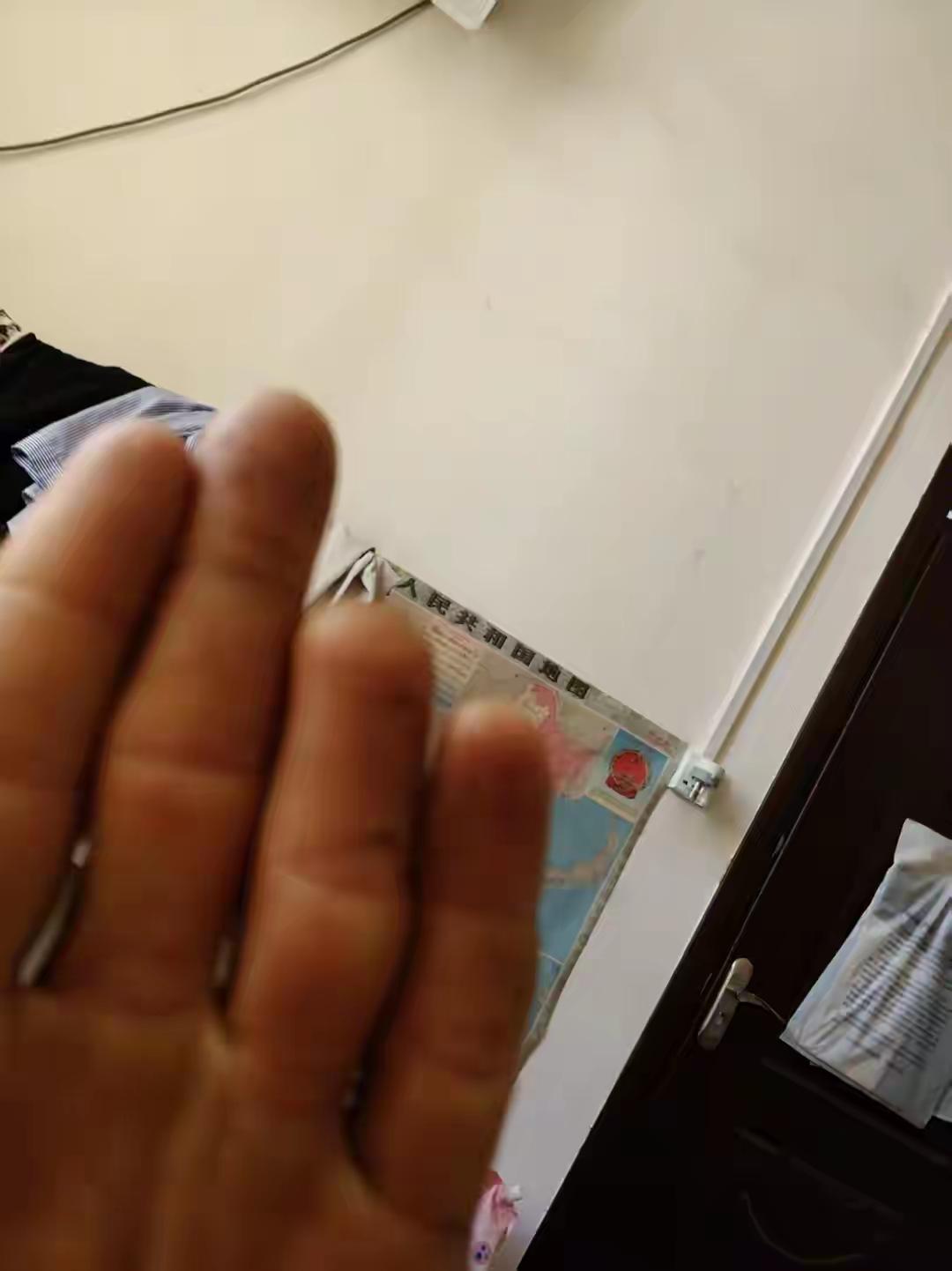 真的太寒心了，重庆，55岁农民工在工地干活被砸断手指，落下终身残疾，官司打遍全部