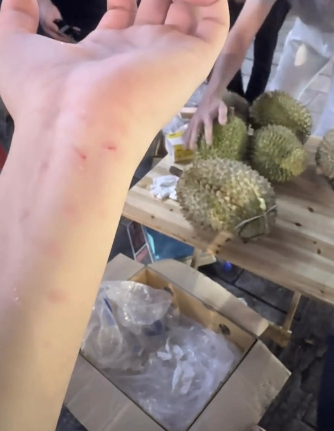 【玉林网友单手提榴莲不小心把手砸到了】7月2日，网友爆料称：玉林街头的单手提榴莲