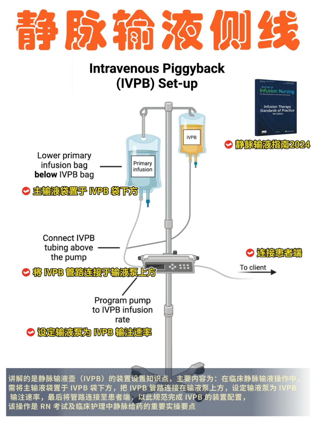 备考RN/静脉输液侧线！！学！！内容