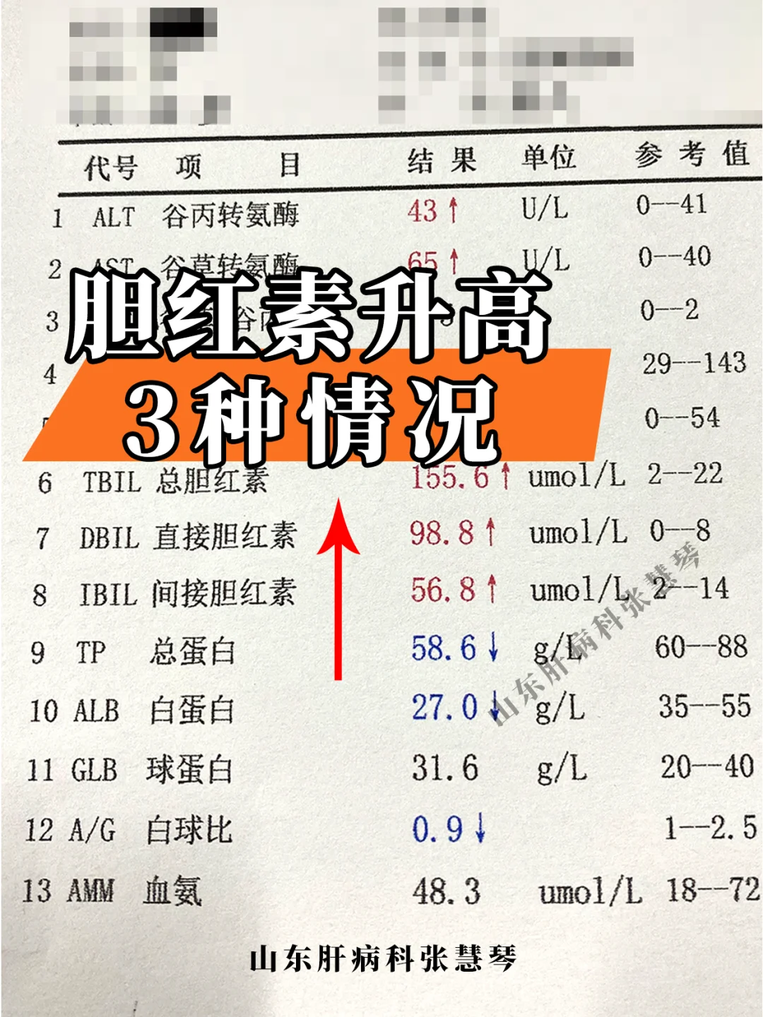 体检查出胆红素升高怎么办？来看这3种情况