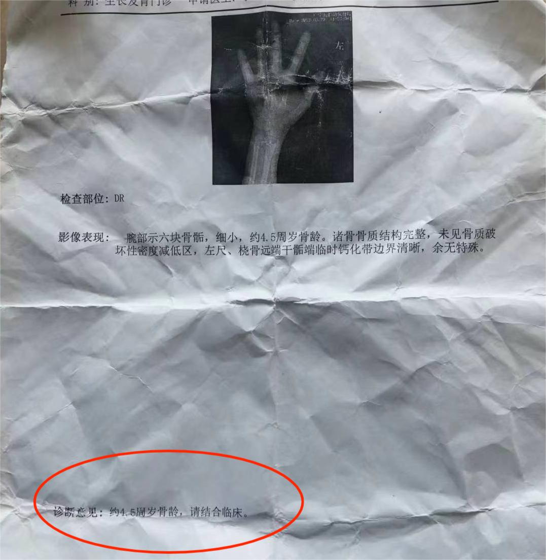 8岁男孩，骨龄只有4岁半，最近一年只长2厘米，是晚长吗？

这个男孩初诊时，身高