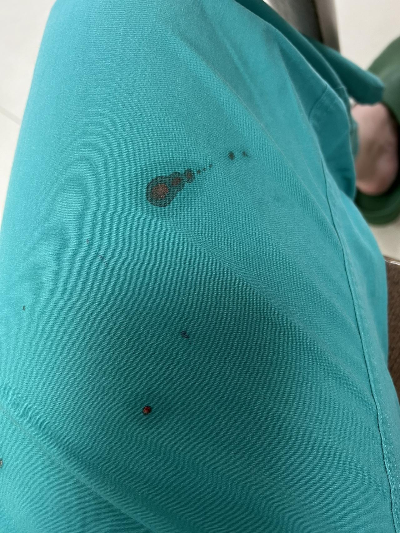 给病人做手术，血溅到裤子上了病房故事