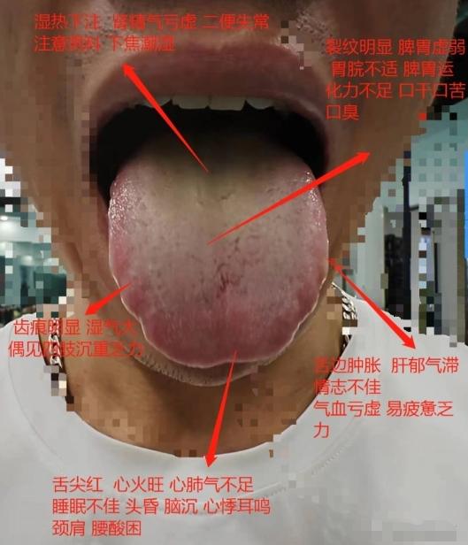 这种舌象，越吃六味地黄肾越虚！
 
患者平时头晕耳鸣，记忆力下降，精神不好，经常