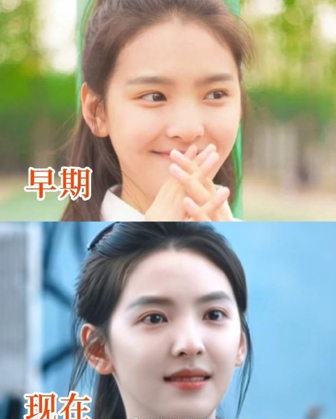 不是 章若楠都有人说她整容？我印象中她是出了名的纯天然啊