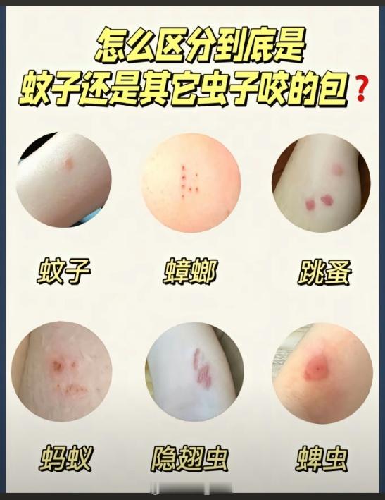 蟑螂咬人 恐怖故事+1，广东的蟑螂不仅会飞...还会咬人上一周才跟一直巨大的蟑螂