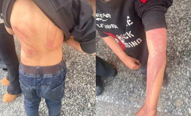 丧尽天良，字字血泪。湖南武冈，才5岁的幼子，被继母一次次烫下体、逼吃大 便、薅掉