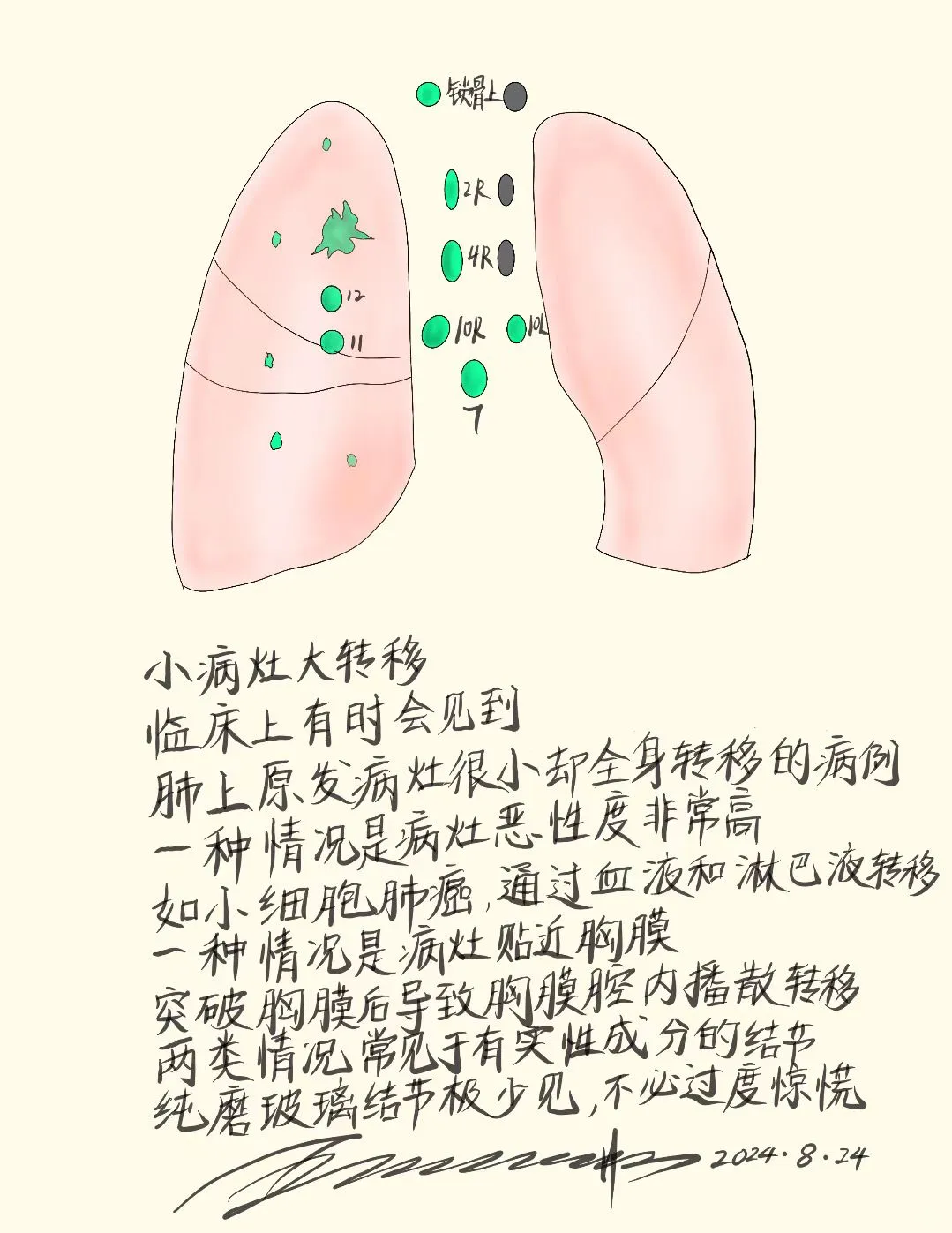 小病灶大转移