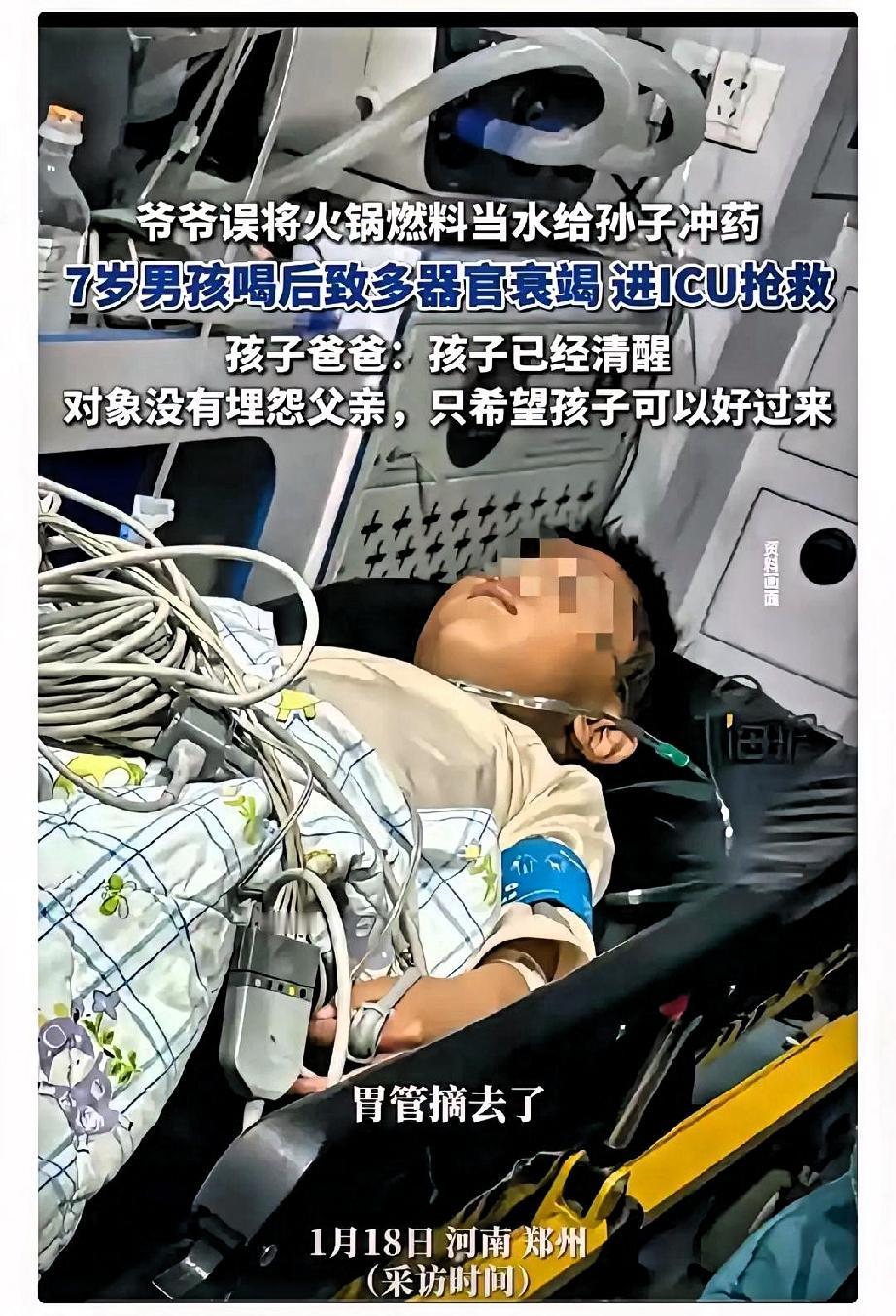 误饮矿物燃料的男孩已经醒了，
但情况不容乐观，
胃管拔了，意识也已恢复，只有肾