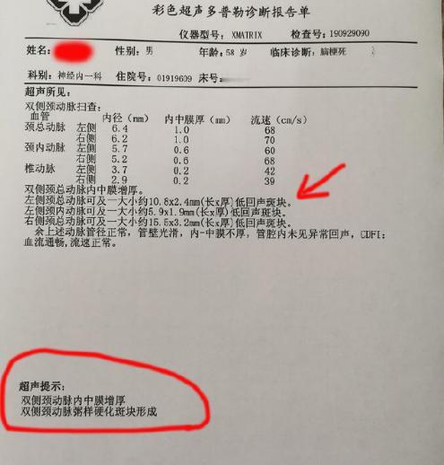 【颈动脉彩超报告】的四个暗示，你一定要知道。
很多朋友做完颈动脉彩超，看着报告上