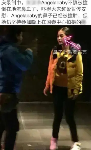 总结下鼻姐受过的伤多次骨折  骨裂  ， 右手大拇指断 骨裂过导致永久性损伤，无