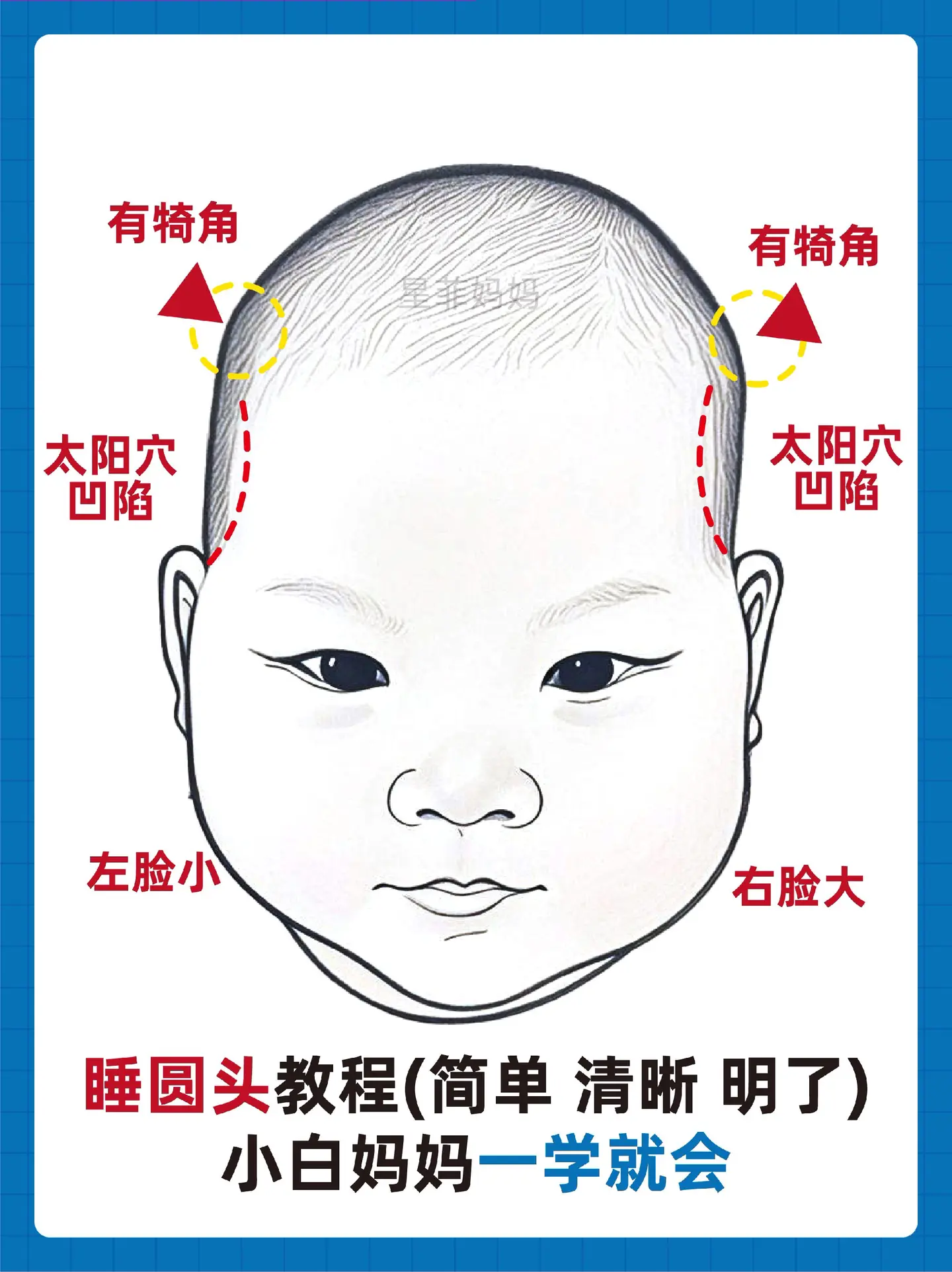 宝宝头型|家长自己学习看头型睡圆头。