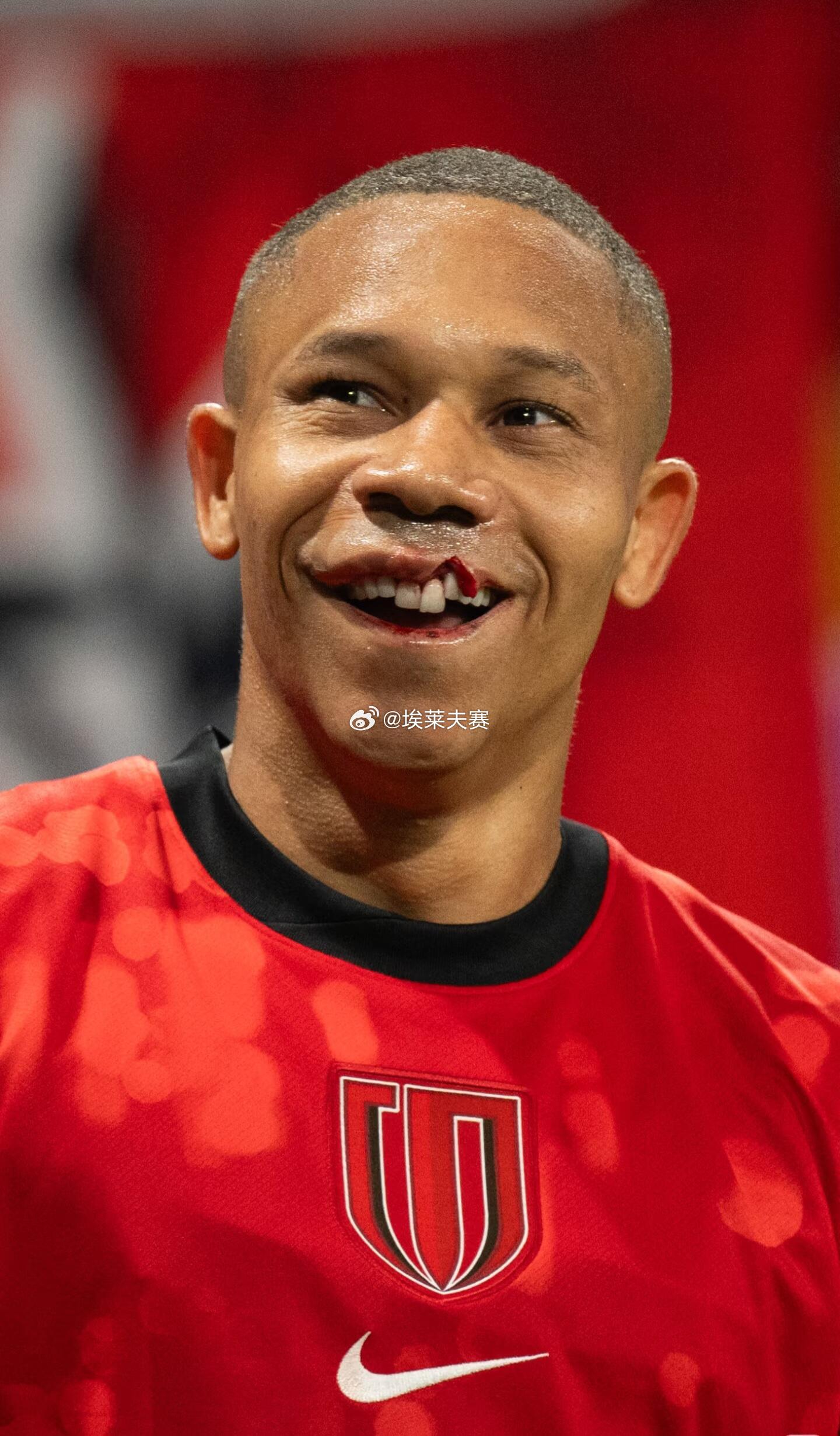 成都蓉城5比1深圳新鹏城姜至鹏直红 这个伤需要手术修复了吧？ 