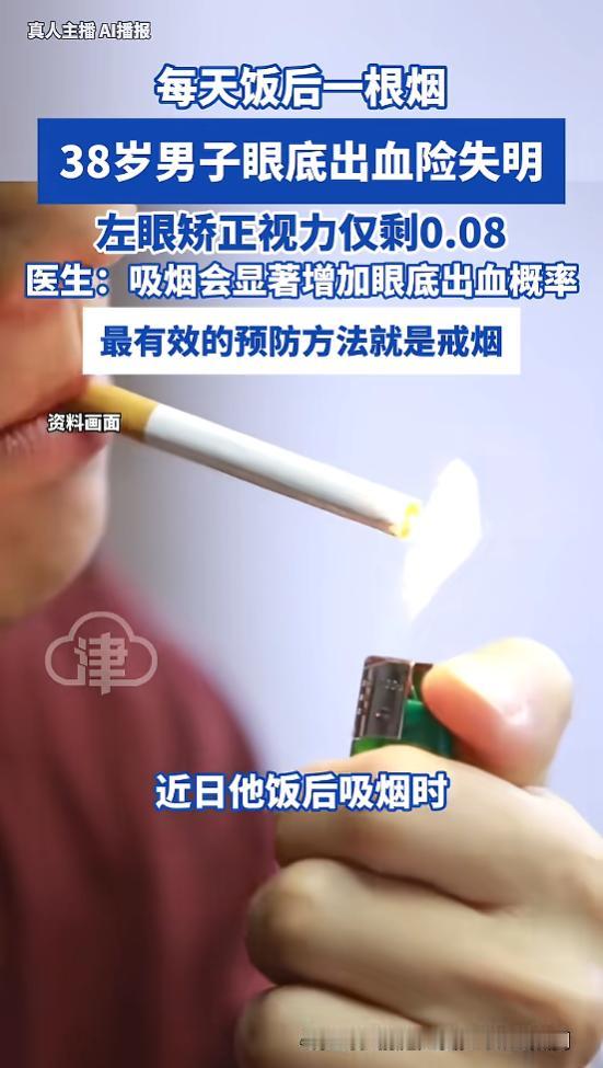 38岁男子饭后一根烟，左眼视力骤降至0.08！眼内竟藏多重病变

4月29日报道