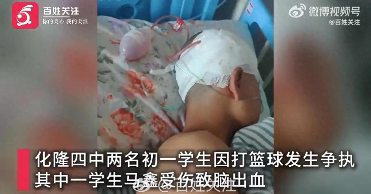 “校方未通知家长，也未及时送医”，初一学生打球遭同学袭击致脑出血
 
两名学生因