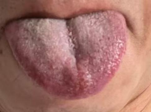 肝肾精血亏虚引发失眠乏力，周身濡养不足该如何调理







有位粉丝向我倾诉