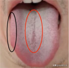 舌头要是长这样，吃啥补药都白搭！这身体就像个漏斗，边补边漏！

患者主诉：精神萎