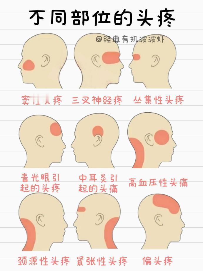 不同部位的疼痛合集！ 