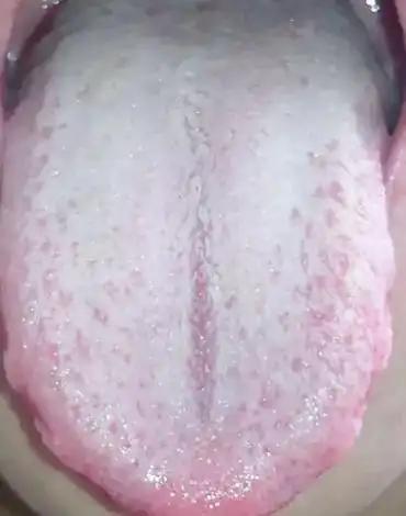 男同志功能差劲，别再瞎补！80%是“郁”不是“虚”，通才是关键！

很多男同志一