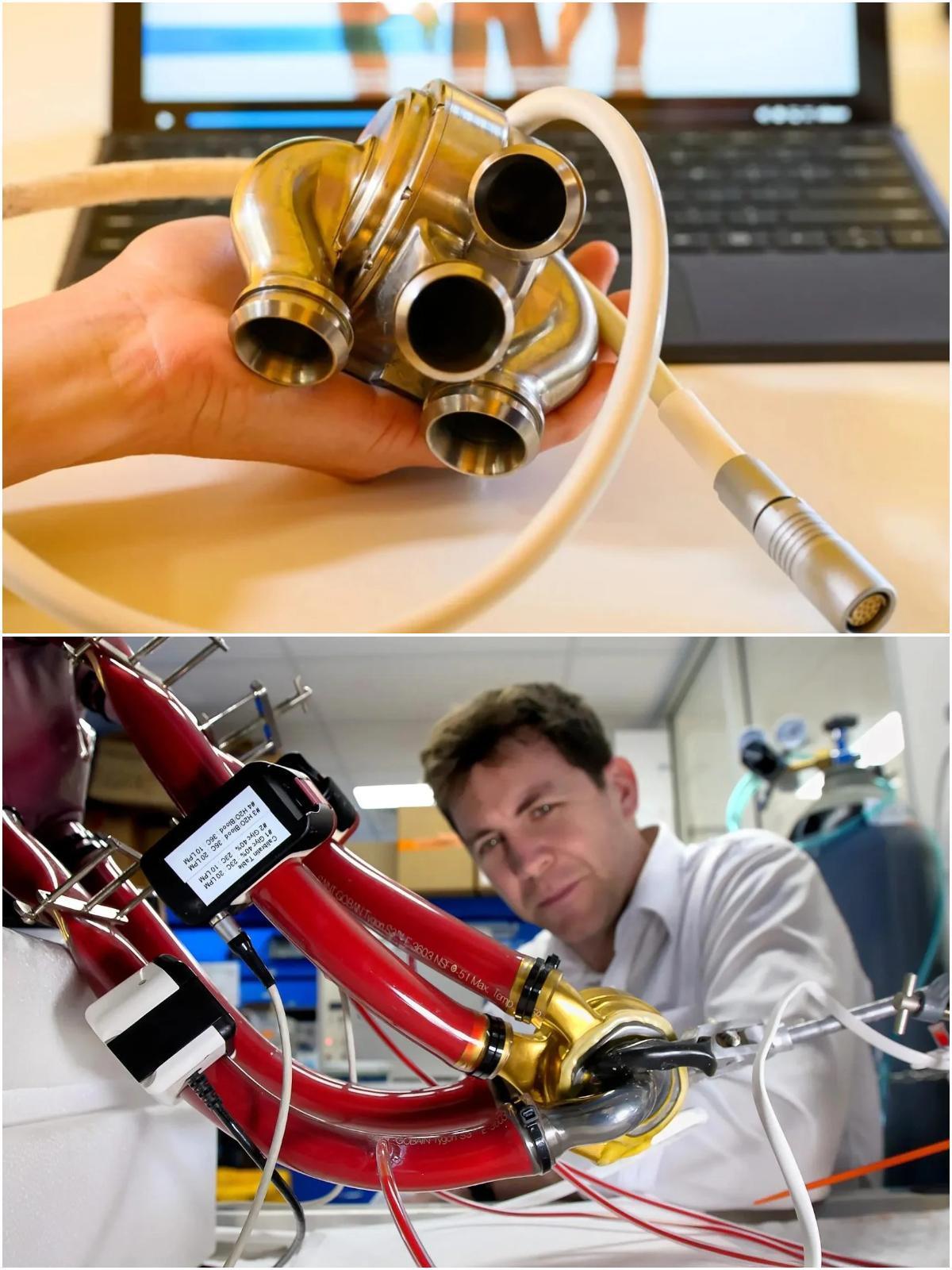 一种植入体内的人工心脏——看起来就像是一个涡轮增压器…

这种全人工心脏（Tot