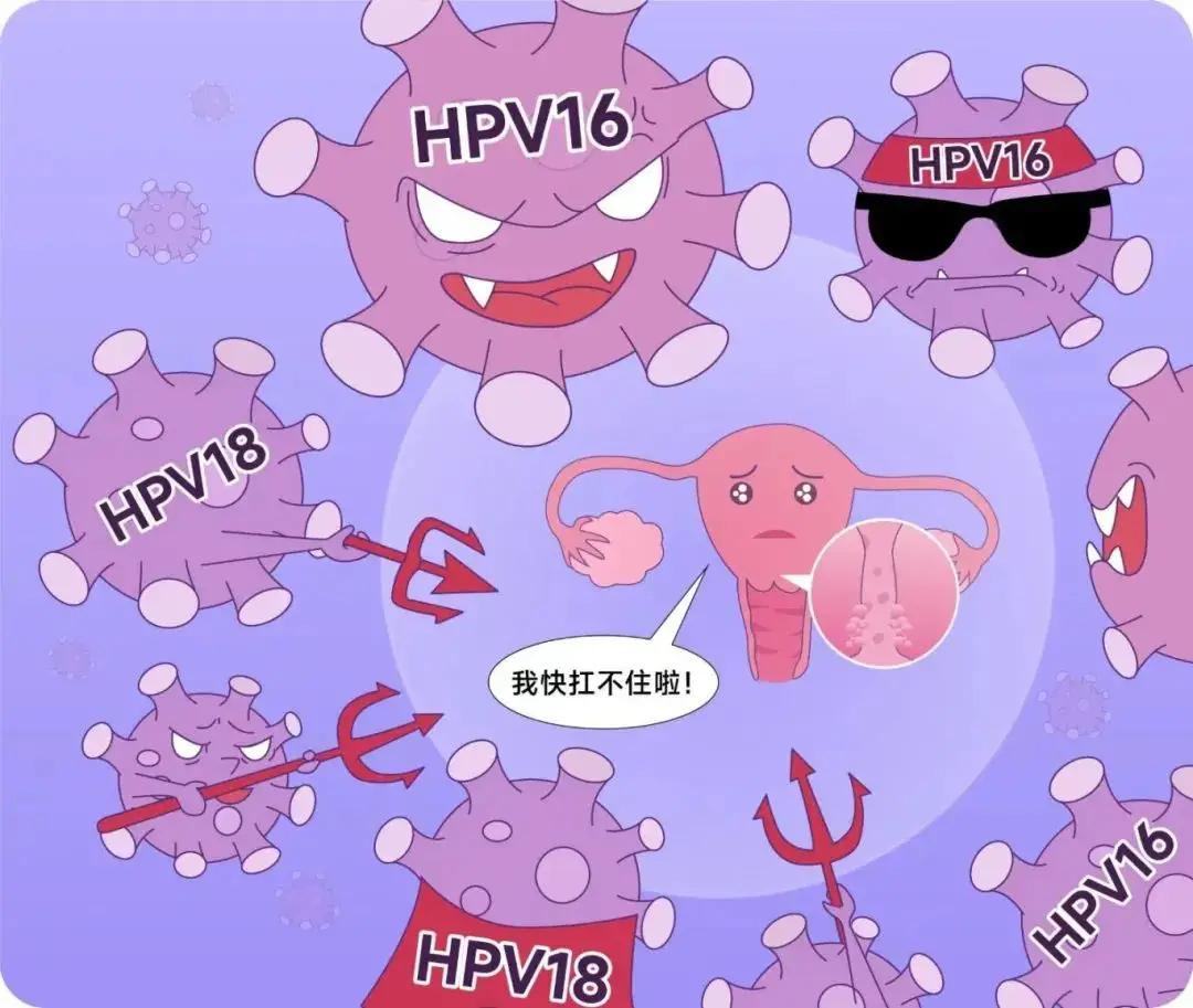感染了HPV，这2种情况最危险！希望你不属于其中任何一种

查出HPV阳性后，很