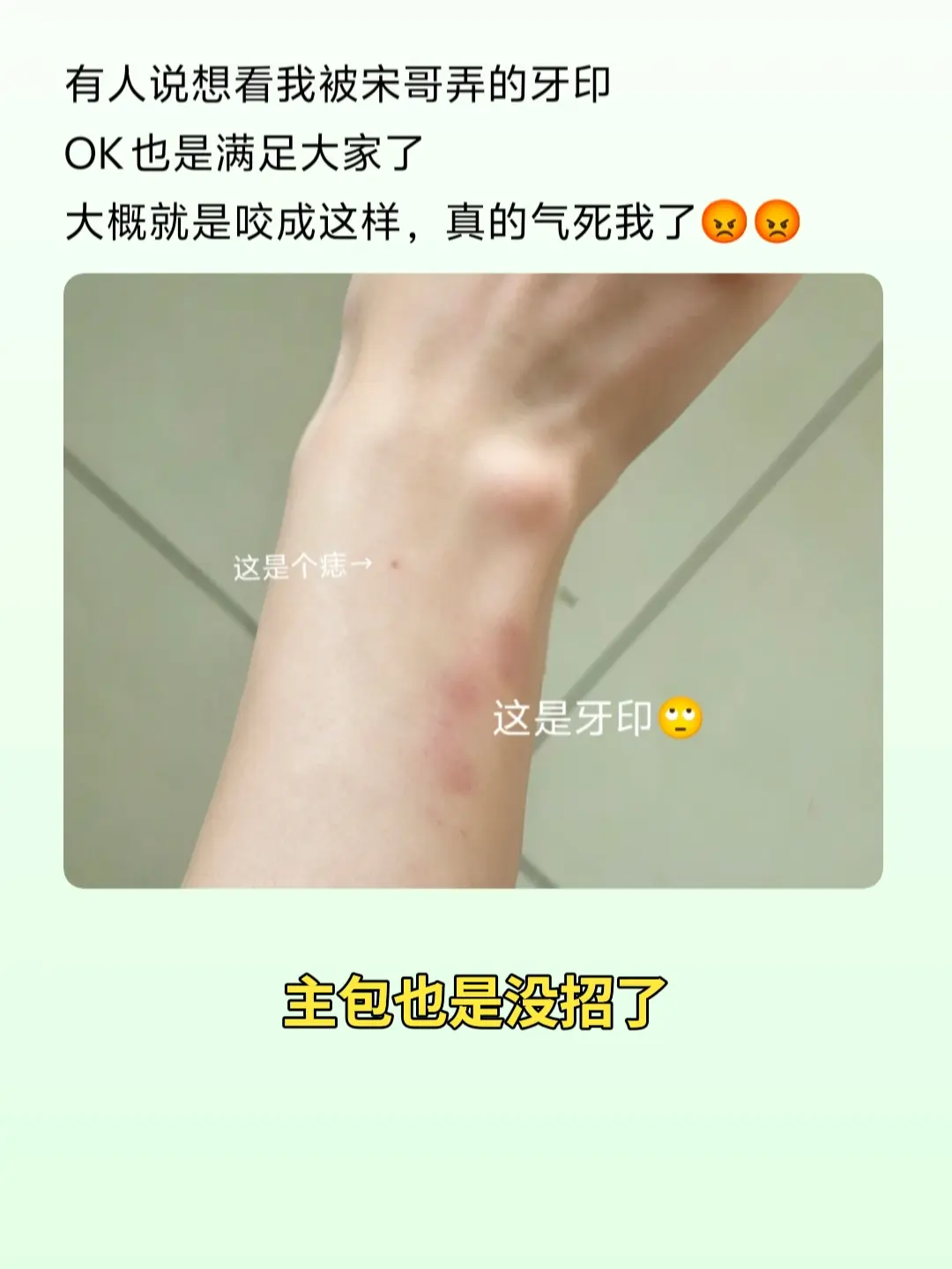 咬合力非常不错了。。。