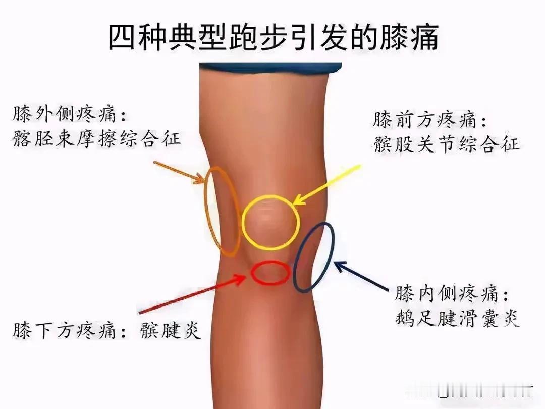 半月板：为什么受伤的总是我？保护膝盖，从自身做起。
