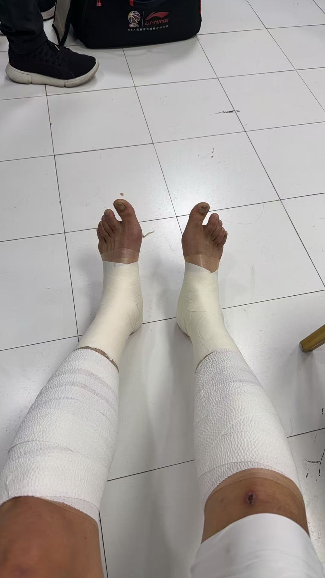 北京首钢北京男篮战胜山西男篮川队拖着两条拉伤的腿，带伤作战，帮助北京客场复仇山西