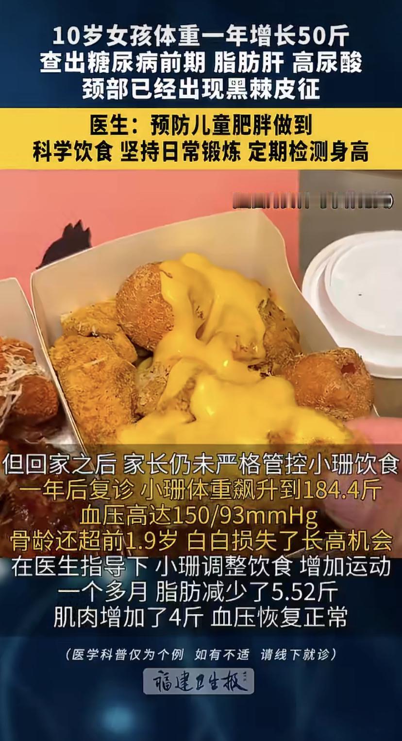 10岁女孩小珊，一年多暴胖50斤，去医院一查，已经是糖尿病前期了!
这孩子从小就