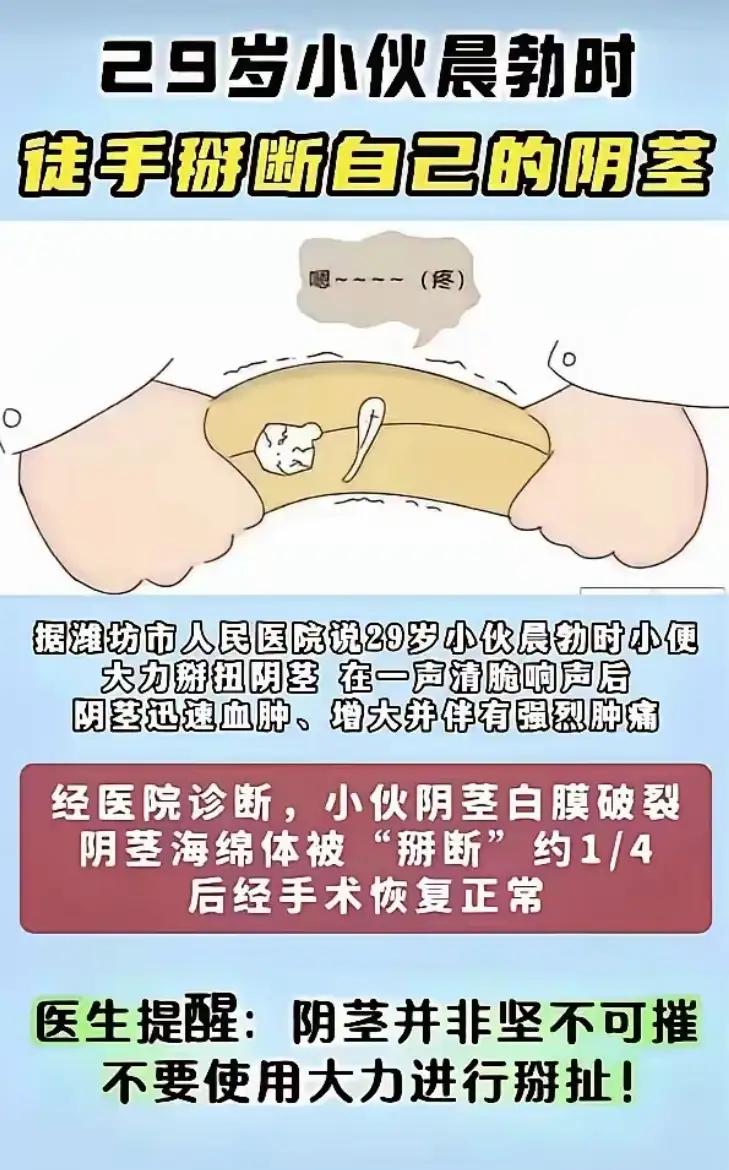 “悲剧”！山东潍坊icon，一29岁男子清晨晨勃时小解，万万没想到，迷迷糊糊状态