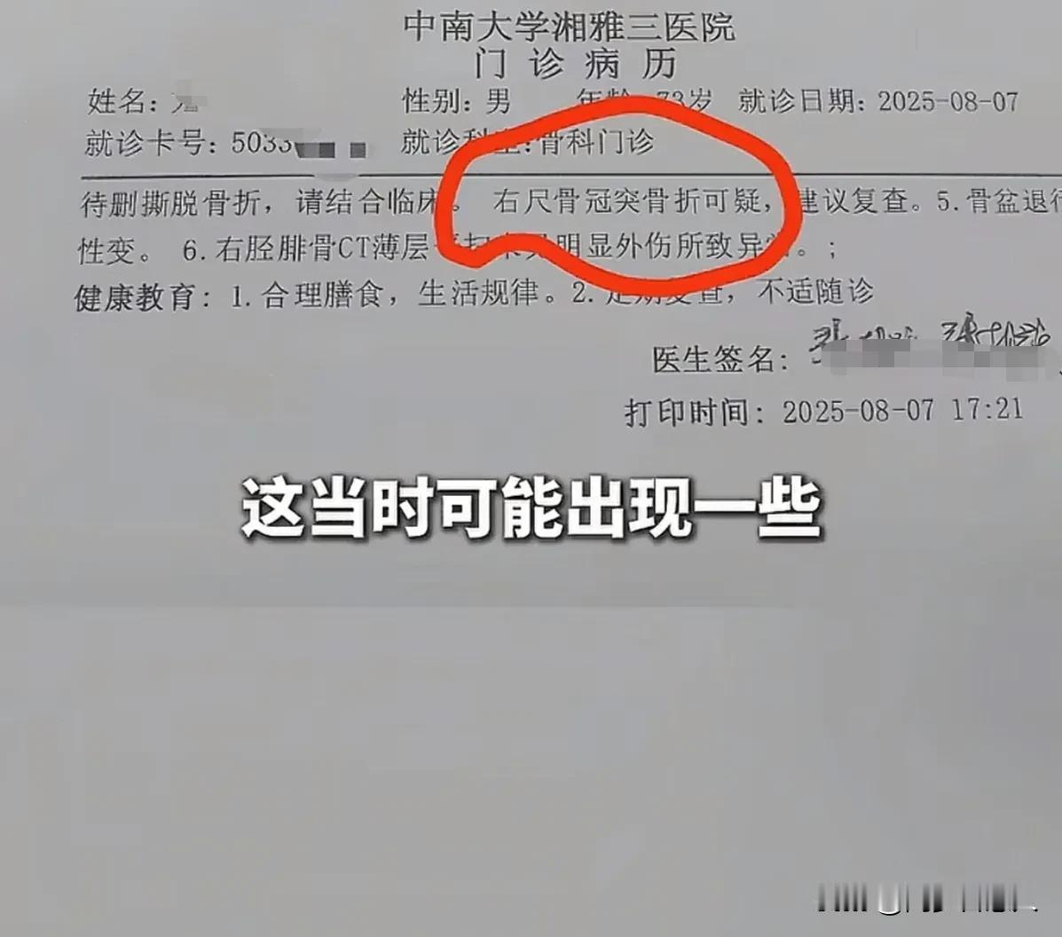百万豪车被骑电动车老人剐蹭，车主拽着老人衣服防止他逃逸，老人格局大让人感动，他叫