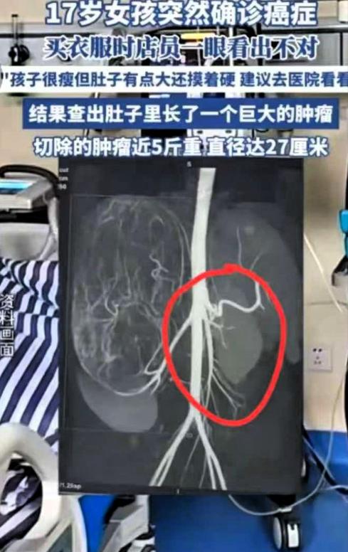 2025年6月，广东17岁女孩和妈妈一起逛街买衣服，在试裤子的时候，老板娘发觉女