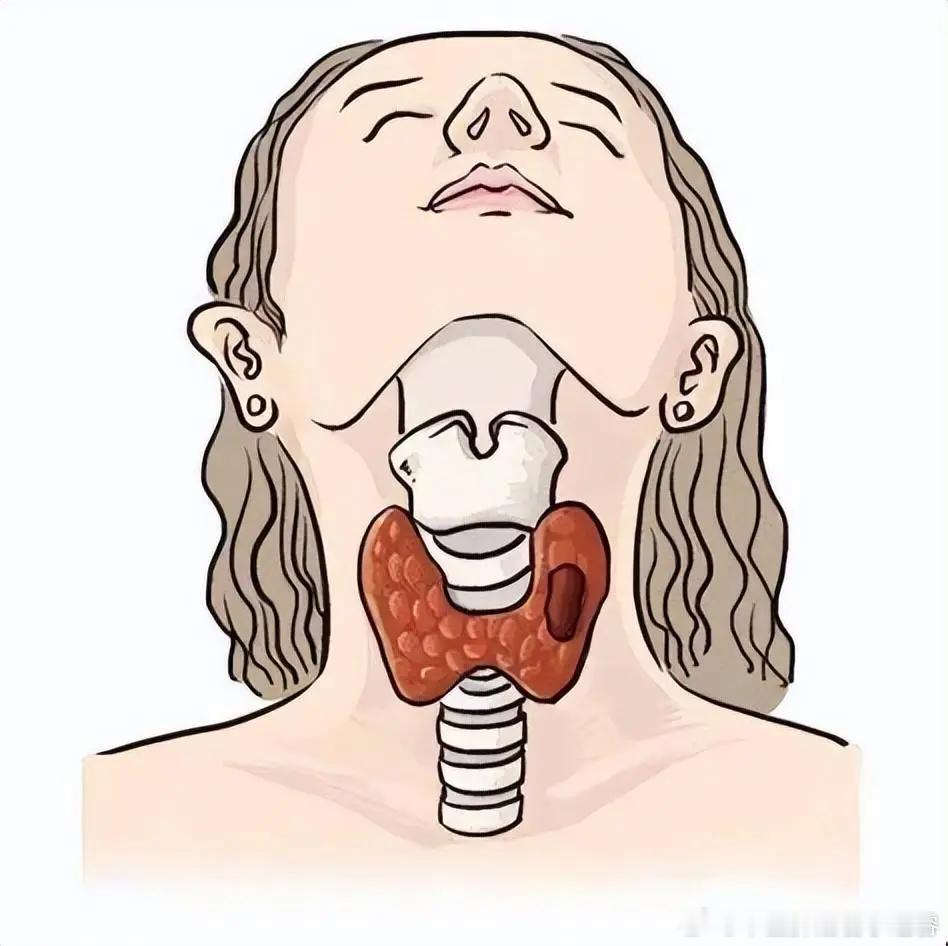 【发现甲状腺结节该怎么办？】健闻登顶计划国医的精诚力量  甲状腺结节很常见，通过