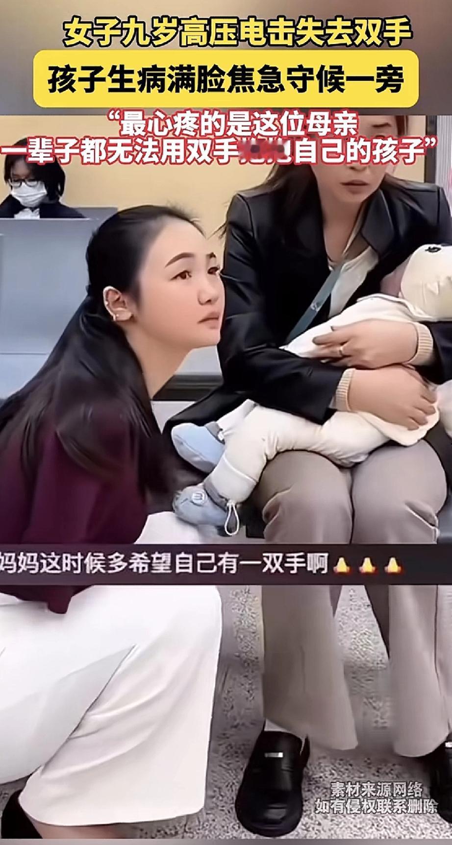 一位母亲9岁时因高压电击失去了双手。如今自己的孩子生病，她满脸焦急地守在旁边，却