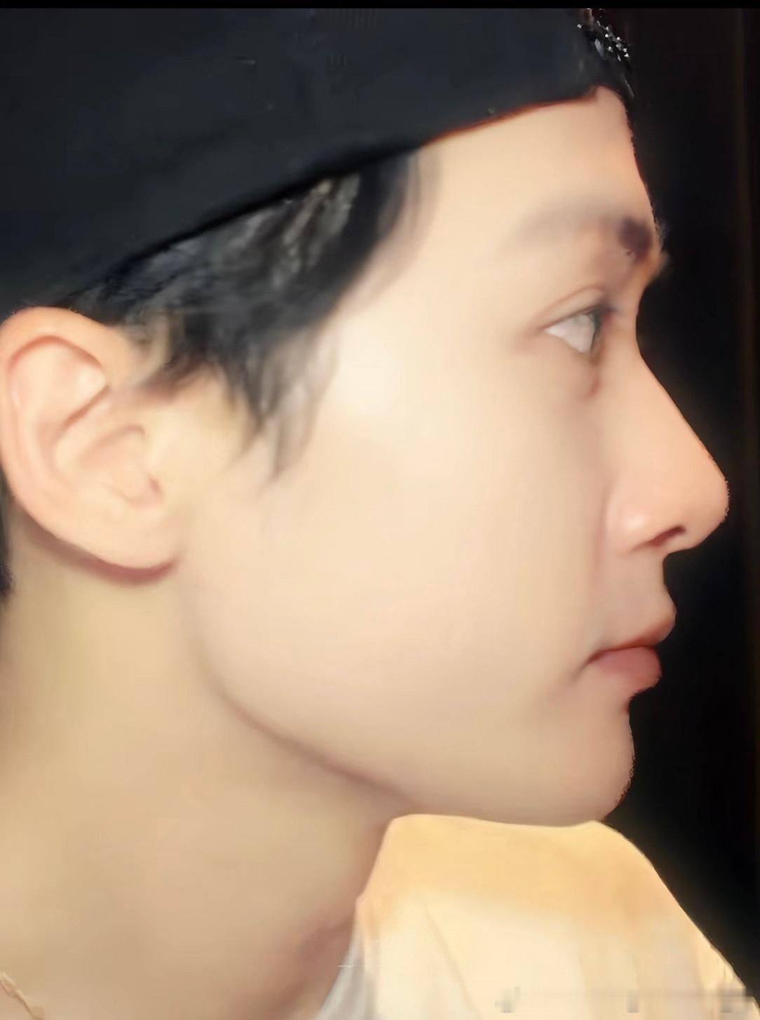 好一张baby face的侧脸! 