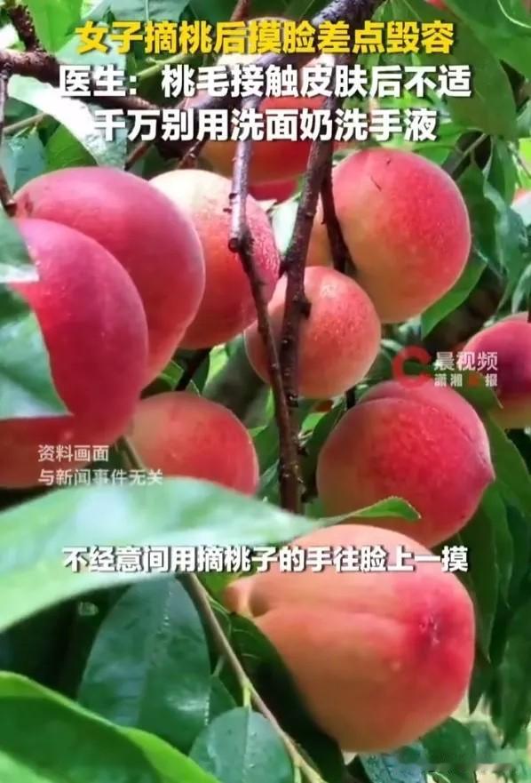 浙江杭州，一女子摘桃子时，手沾了桃毛，随后用手摸了下脸，没想到过了一会儿，她就感
