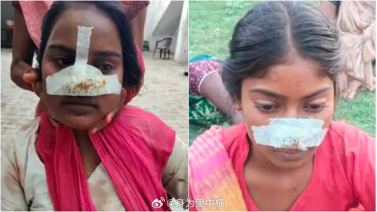 【印度拉胡尔普尔卡赫里离奇伤人案】🕙 几天前📍印度拉胡尔普尔卡赫里（Rahu