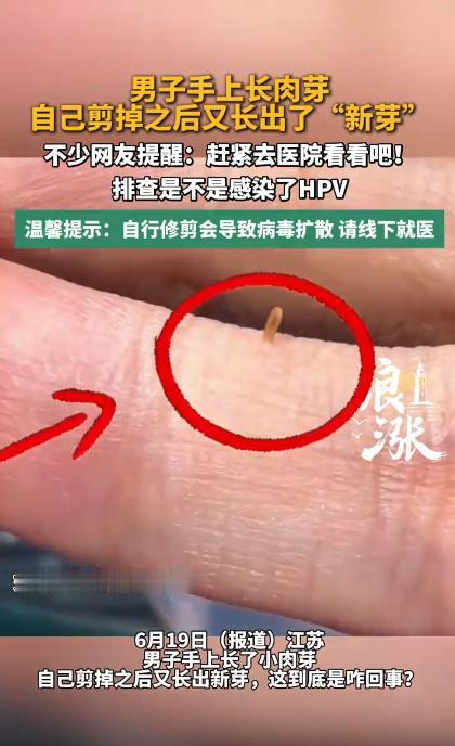 悲剧还是发生了！最近江苏一个男子遇到了糟心事，他手上长了个不痛不痒的小肉芽，自己