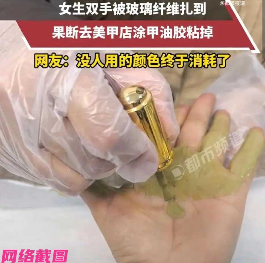 浙江有名女生，这次让玻璃纤维把自己的双手扎伤，这时女生没有选择去医院处理，而是跑