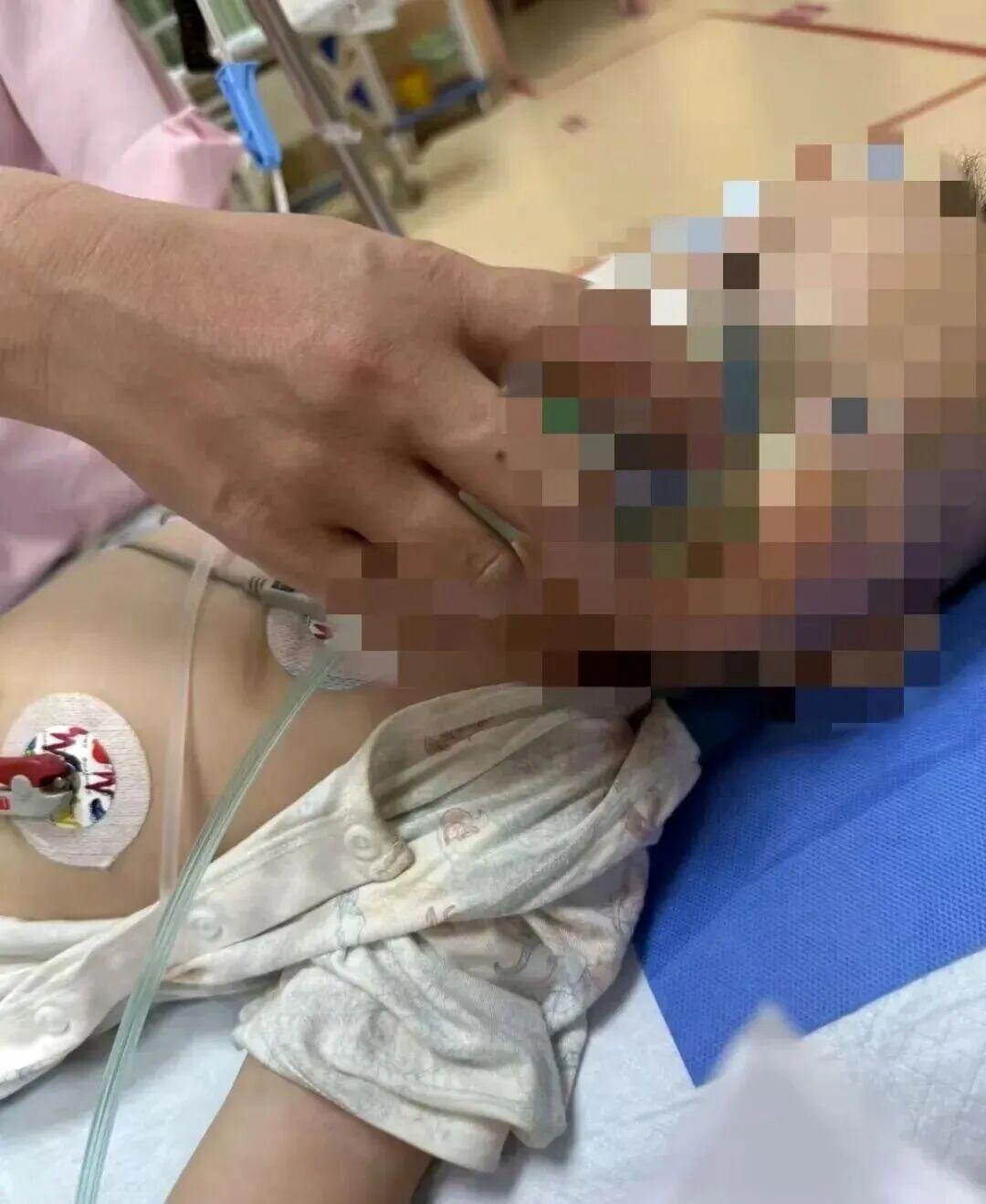 贵州，一户业主，为了赶走家门的黄鼠狼，把老鼠药打进鸡蛋里做诱饵，丢放到各个地方。
