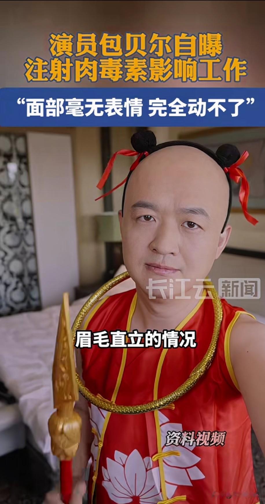 包贝尔说因为祛除皱纹
注射了肉毒素后，出现额头平整僵硬
眉毛直立的情况，导演让他