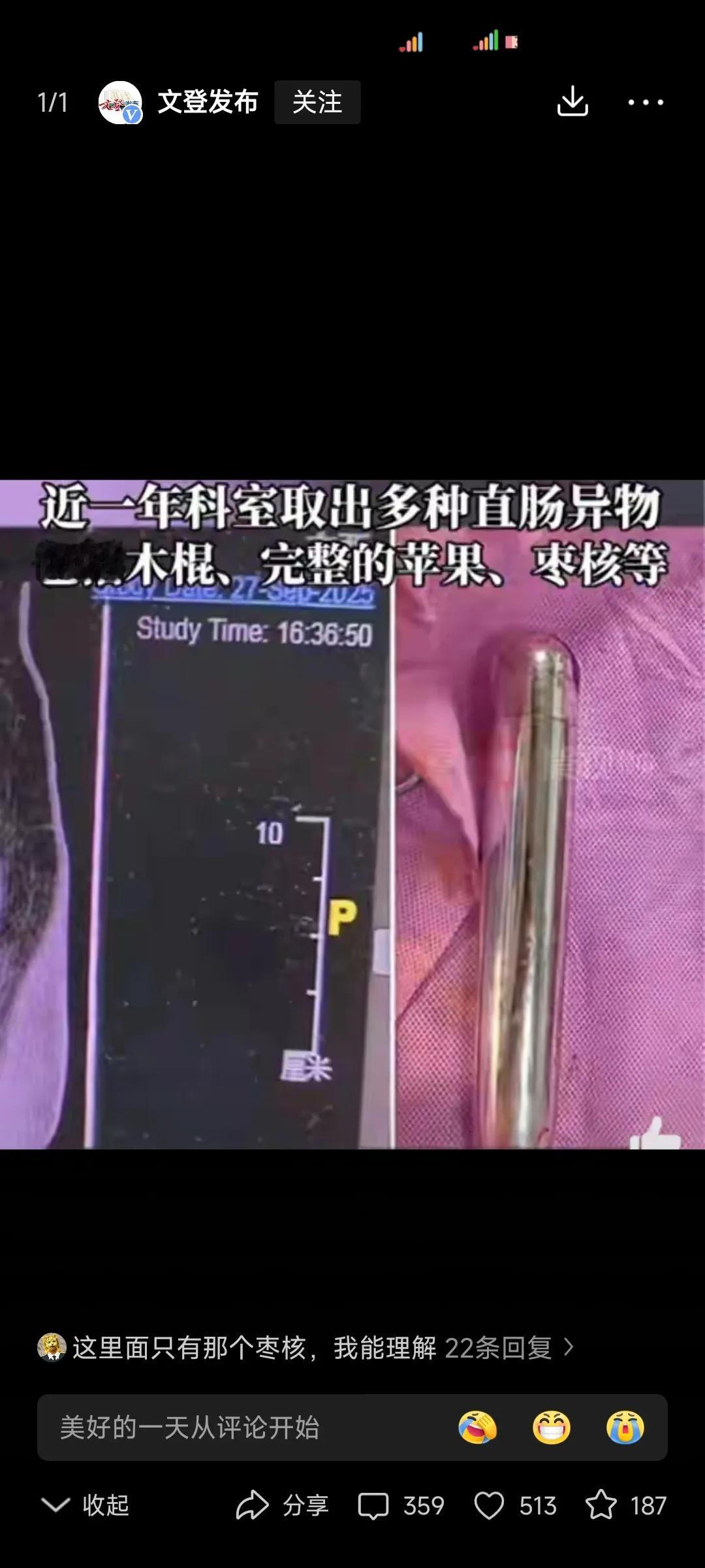 非人类的操作，看到这个都理解不了。
这些人是什么思维。
认真找个对象，什么事都解
