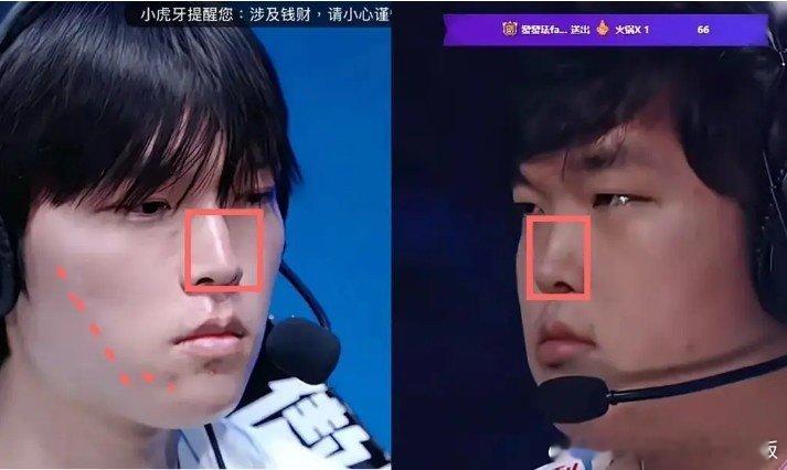 网友细扒Bin脸部变化细节Bin休赛期回归之后，外形上的变化迅速引发网友热议，不