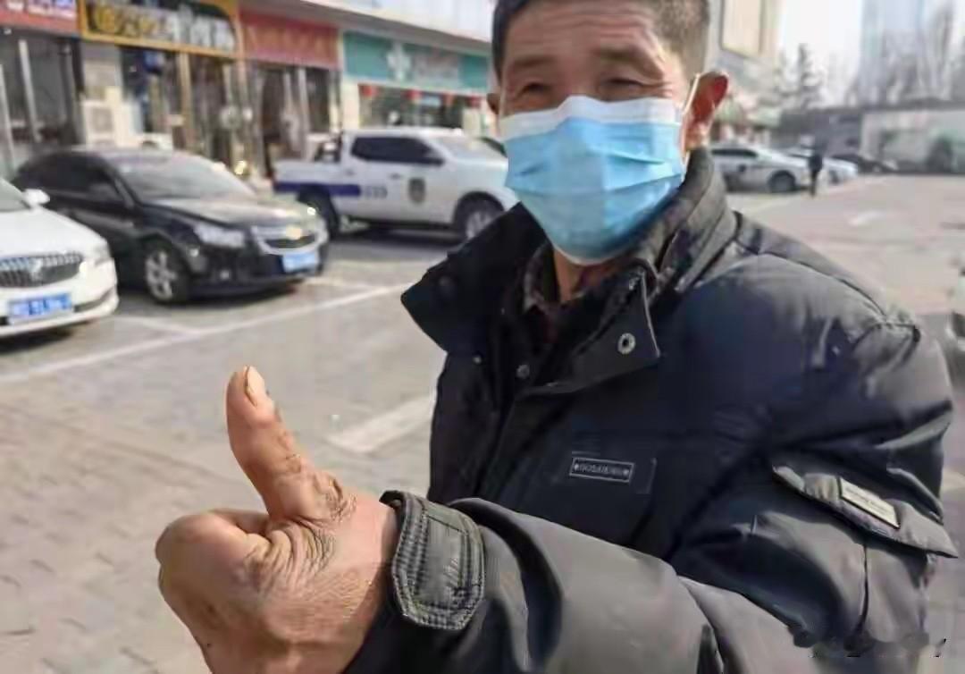 简直就是十恶不赦！患者彭先生花了14万做手术接断指，救命的器材却被医生直接扔进了