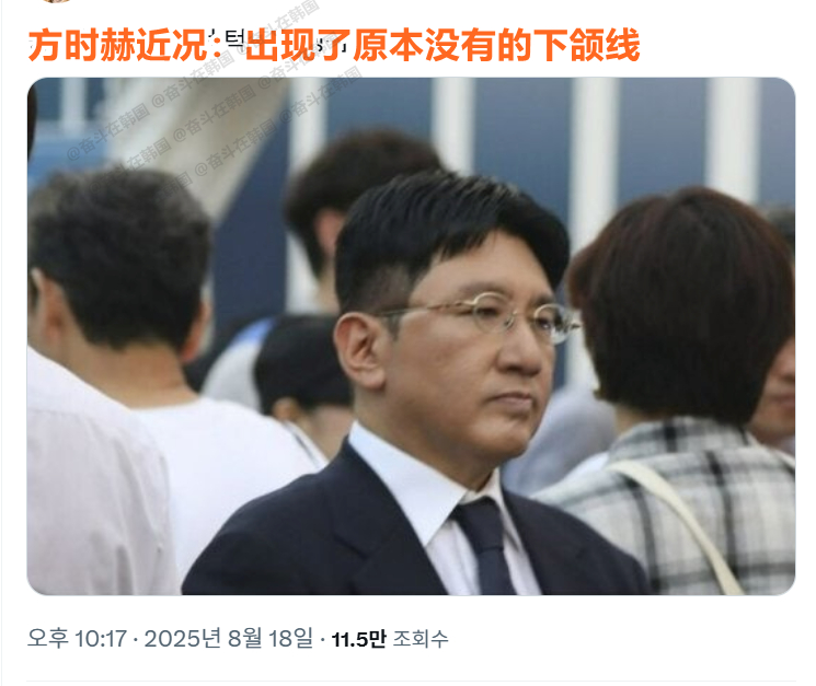 方时赫近况：出现了原本没有的下颌线 海外新鲜事热点现场 ​​​