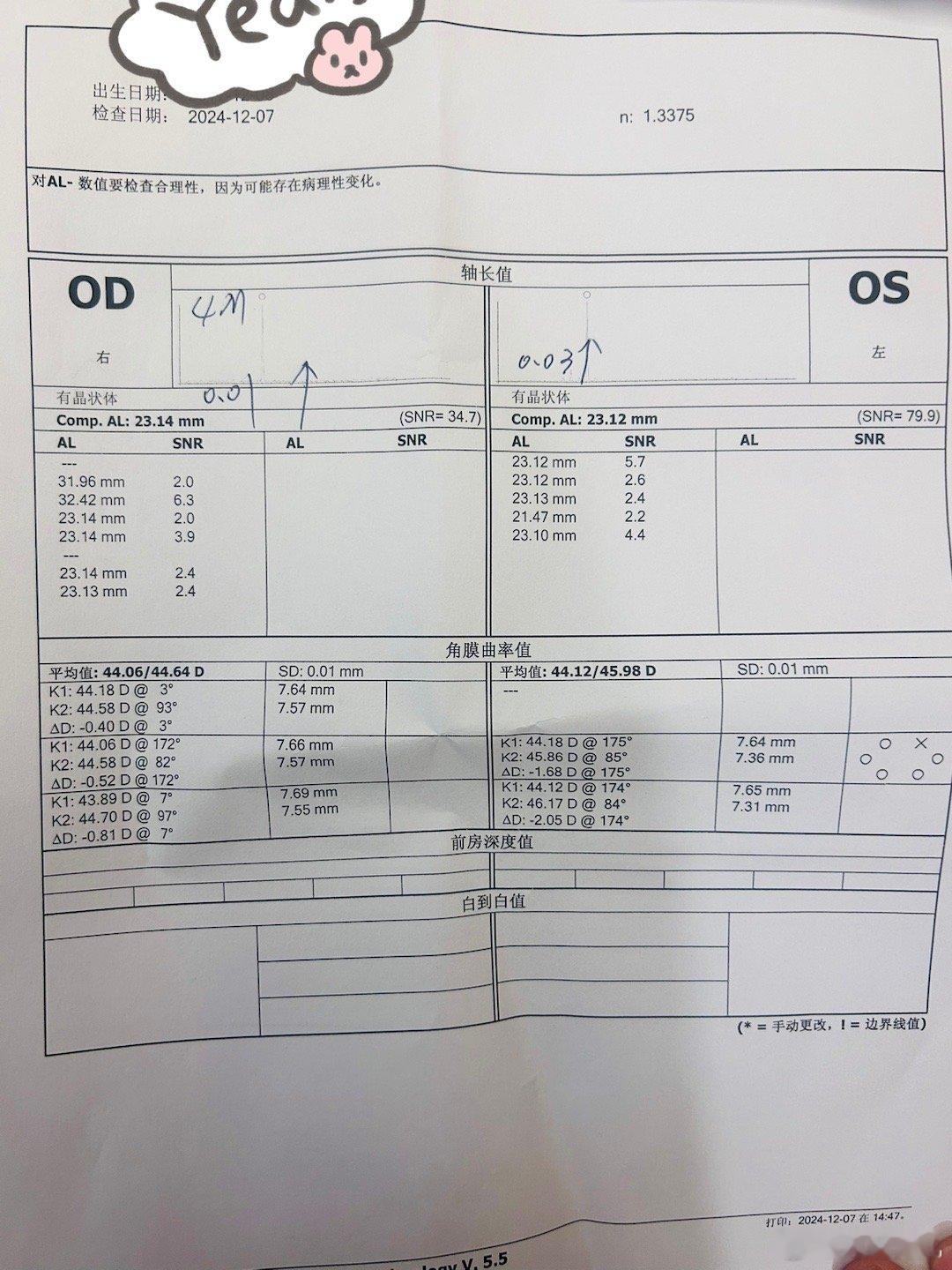 带小风检查视力回来，4个月眼轴只涨了0.01和0.03，太开心了[打call]大